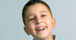 Kids dentist in Bangalore
