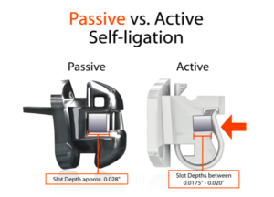 Active and passive self ligating brackets