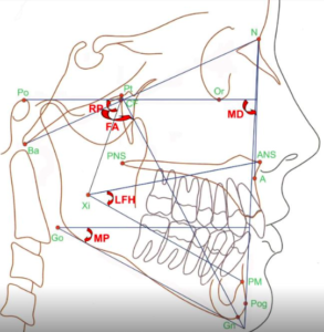 Step 5 - Facial Form Assessment