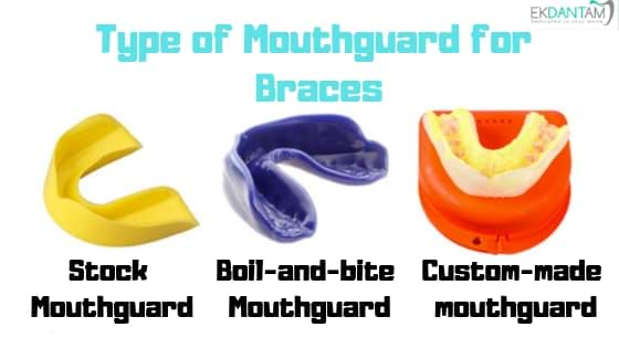 Difference between theTMJ Mouth Guard and a Regular Mouth Guard