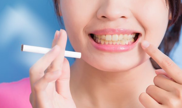 Role of Lifestyle in Oral Hygiene
