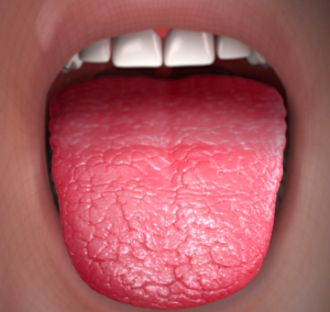 Mouth breathing can lead to dry mouth and bad breath