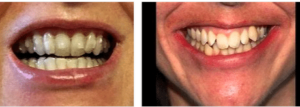 Do-you-have-to-be-an-orthodontist-to-provide-Invisalign