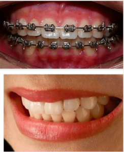 What-are-the-main-fields-of-study-for-orthodontists