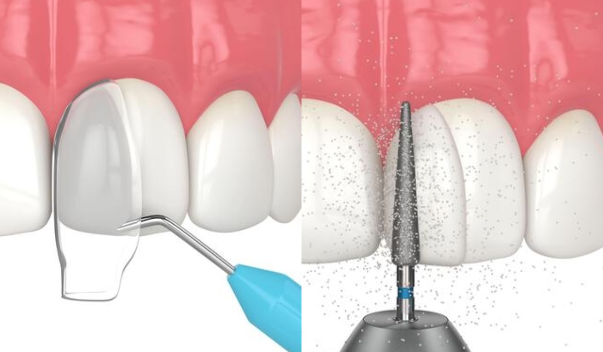 Orthodontic Treatment in Whitefield