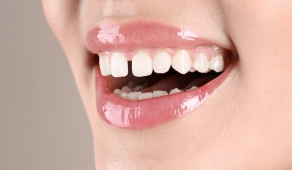 Orthodontist Near me in Whitefield