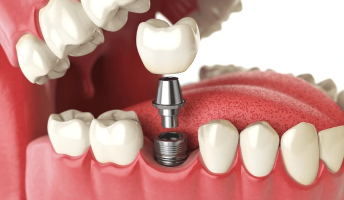 Orthodontic Treatment in Whitefield
