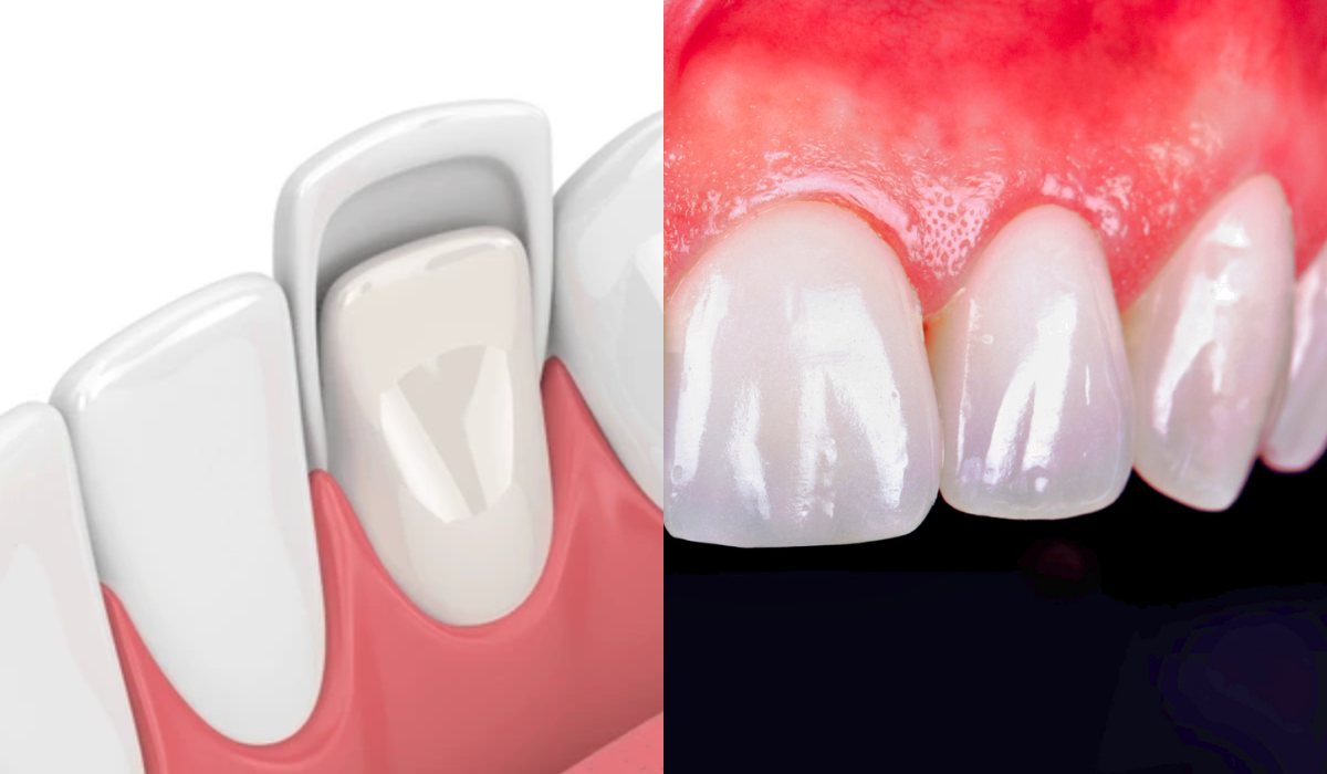 Skilled Dentist near me in whitefield