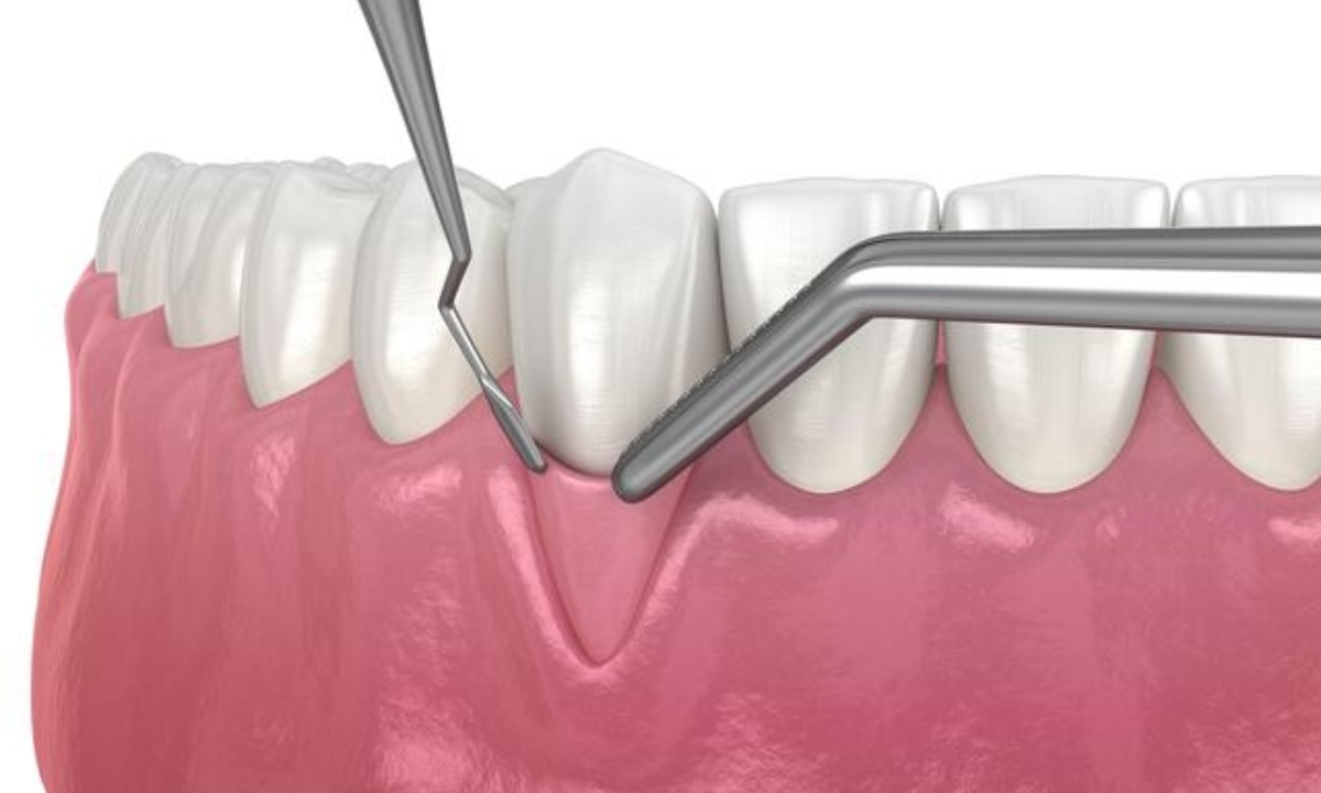 Dental Clinic in Whitefield