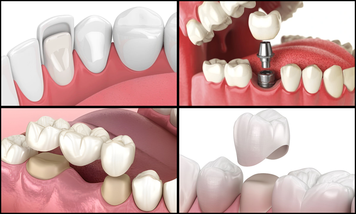 Dental Clinic in Whitefield
