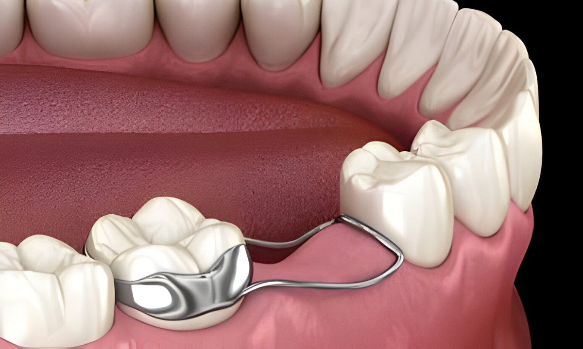 Dentist in Whitefield, Bangalore