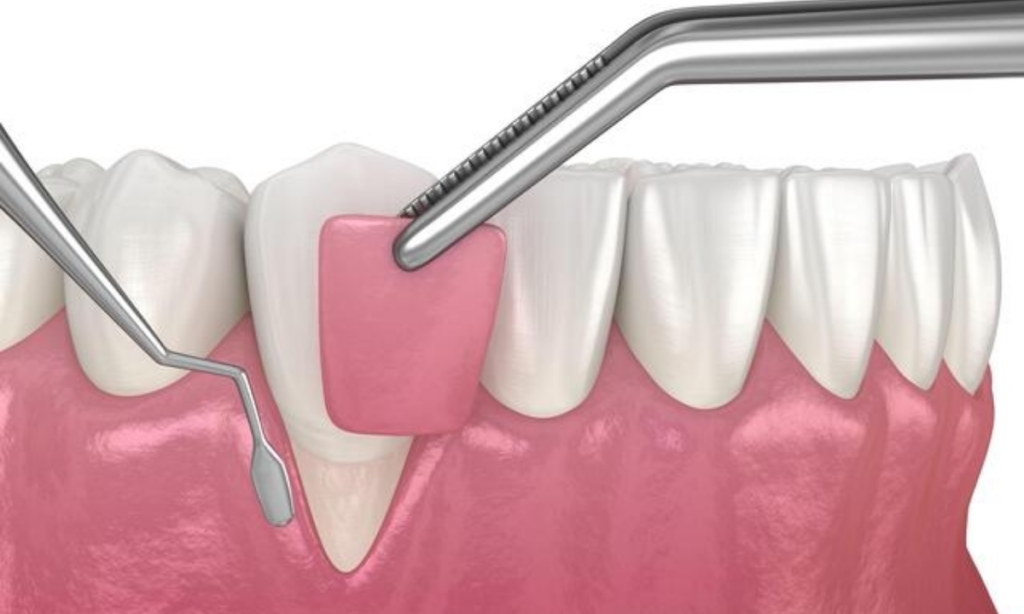Dentist in Whitefield