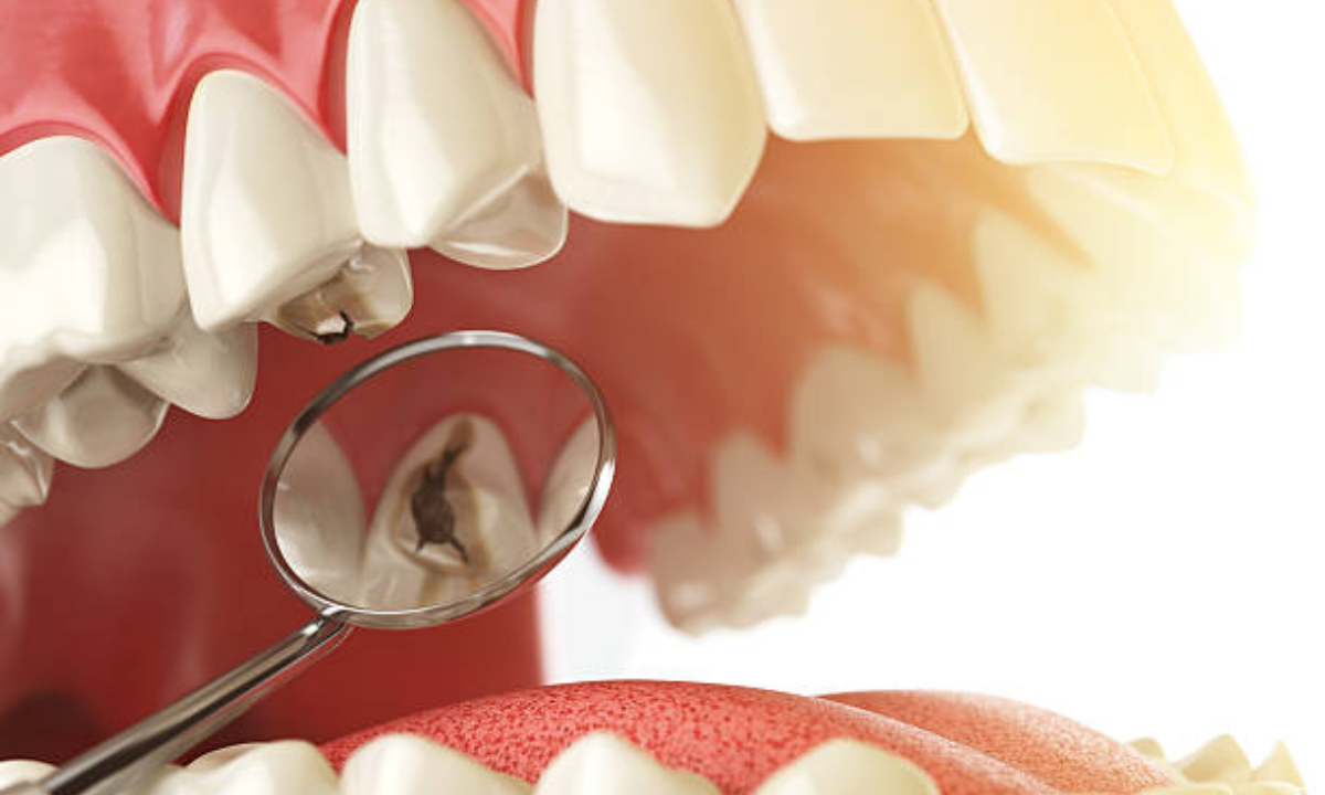 Dental Clinic in Whitefield