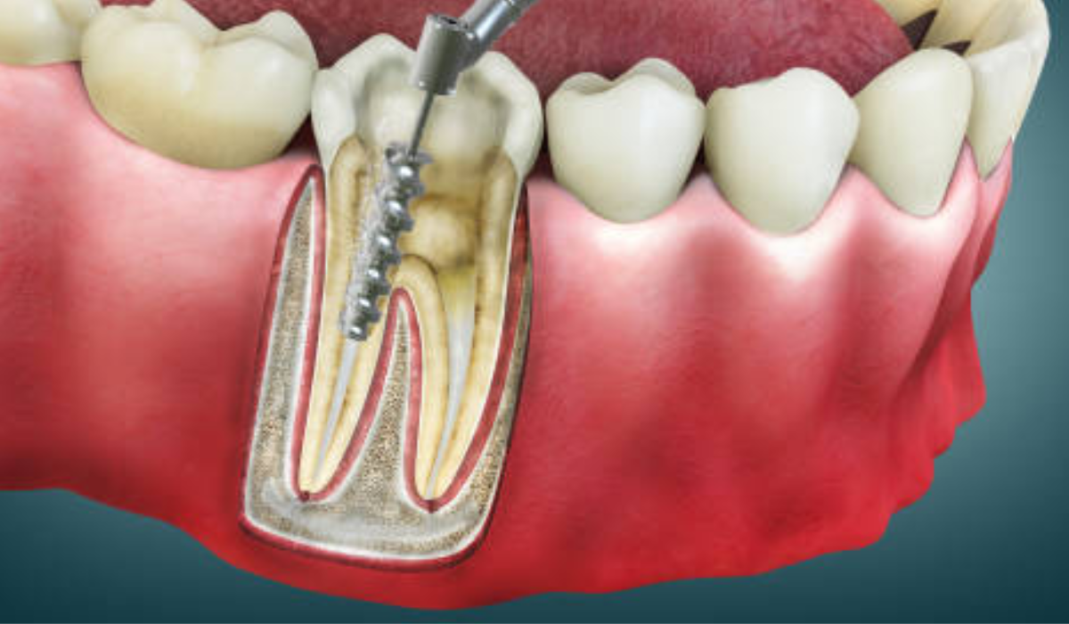 Dentist in whitefield
