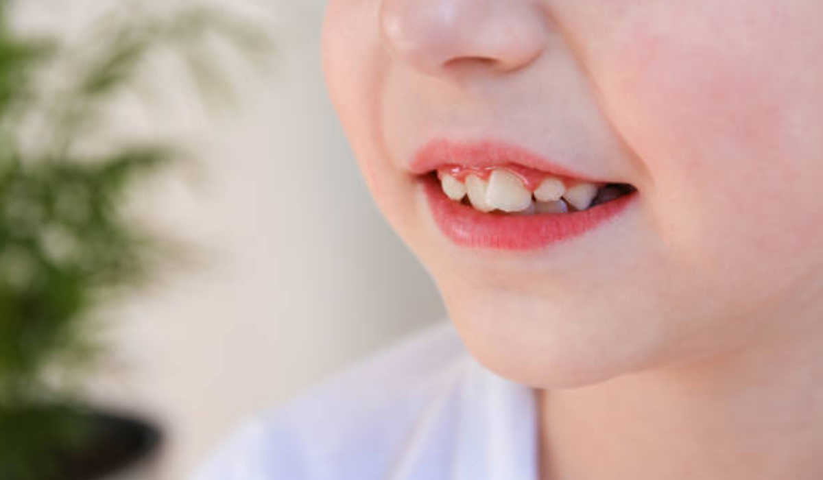 Dentist in whitefield