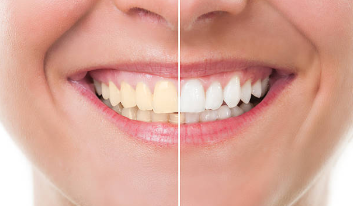 Cosmetic Dentist in Whitefield