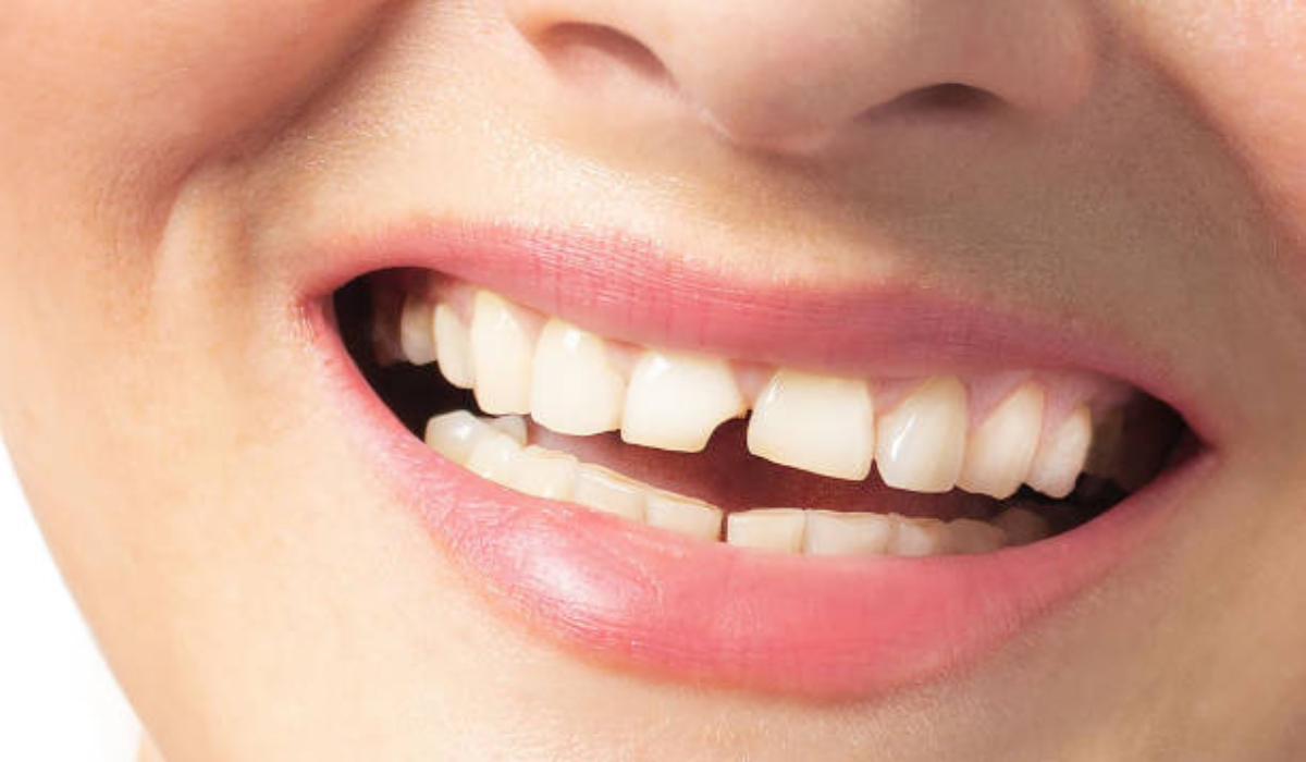 Dental clinic in whitefield