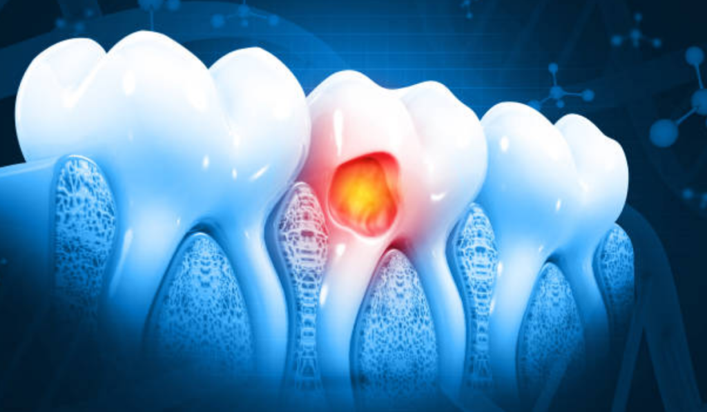 Dental Clinic in Whitefield