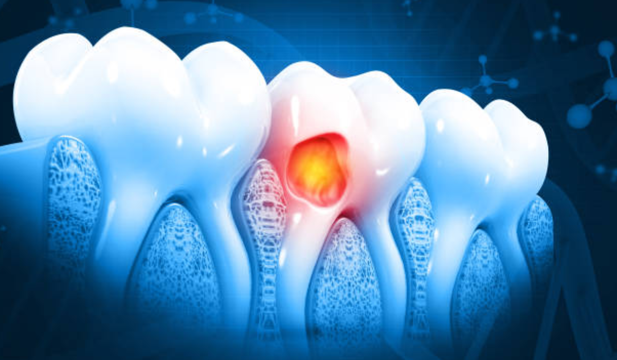 Dental Clinic in Whitefield