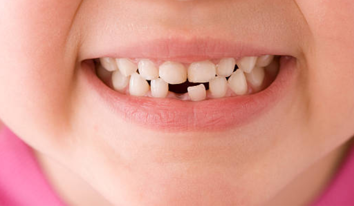 Dentist in whitefield