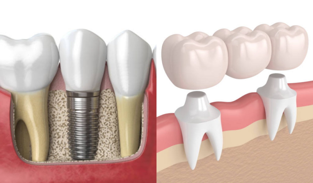dental clinic in whitefield