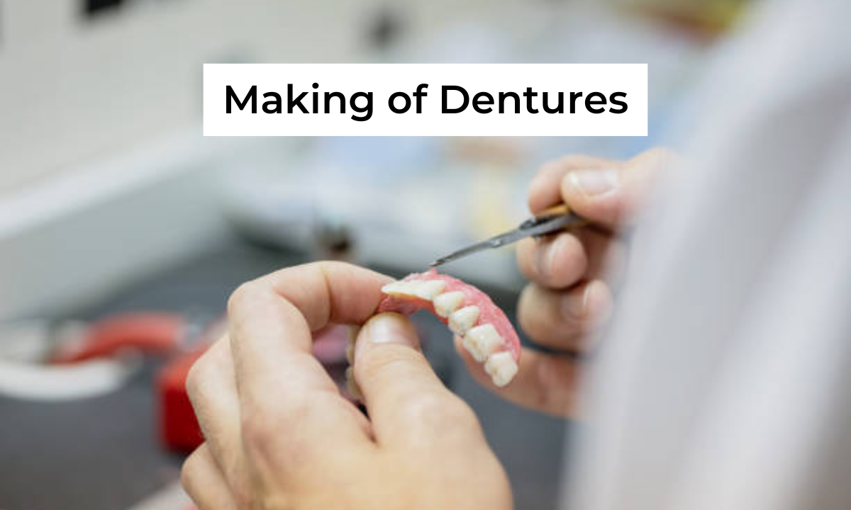 Partial Denture in Whitefield