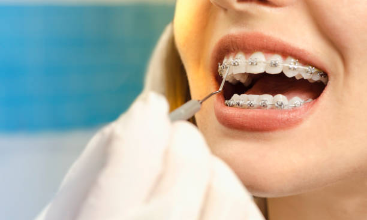 Orthodontic Treatment in Whitefield