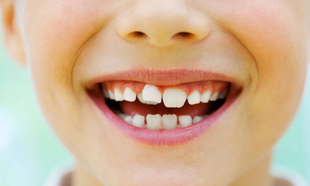dental clinic in Whitefield