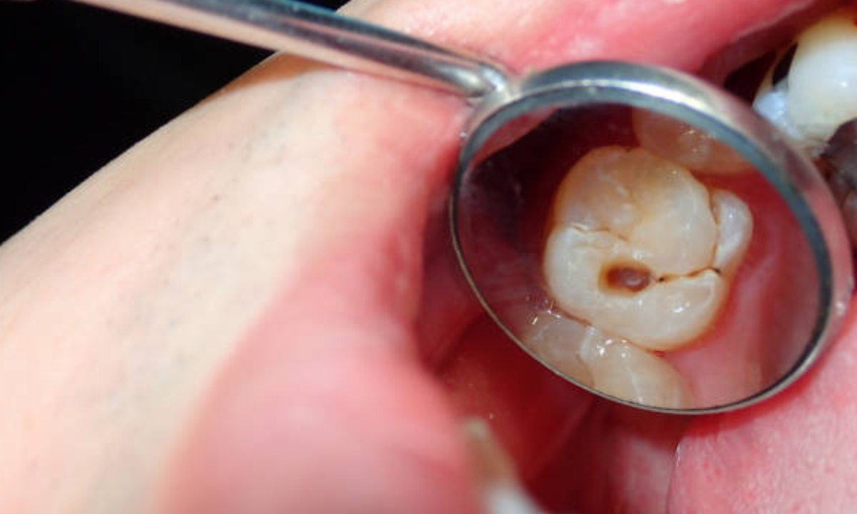 dental clinic in Whitefield Bangalore