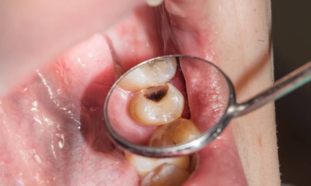 dentist in Whitefield