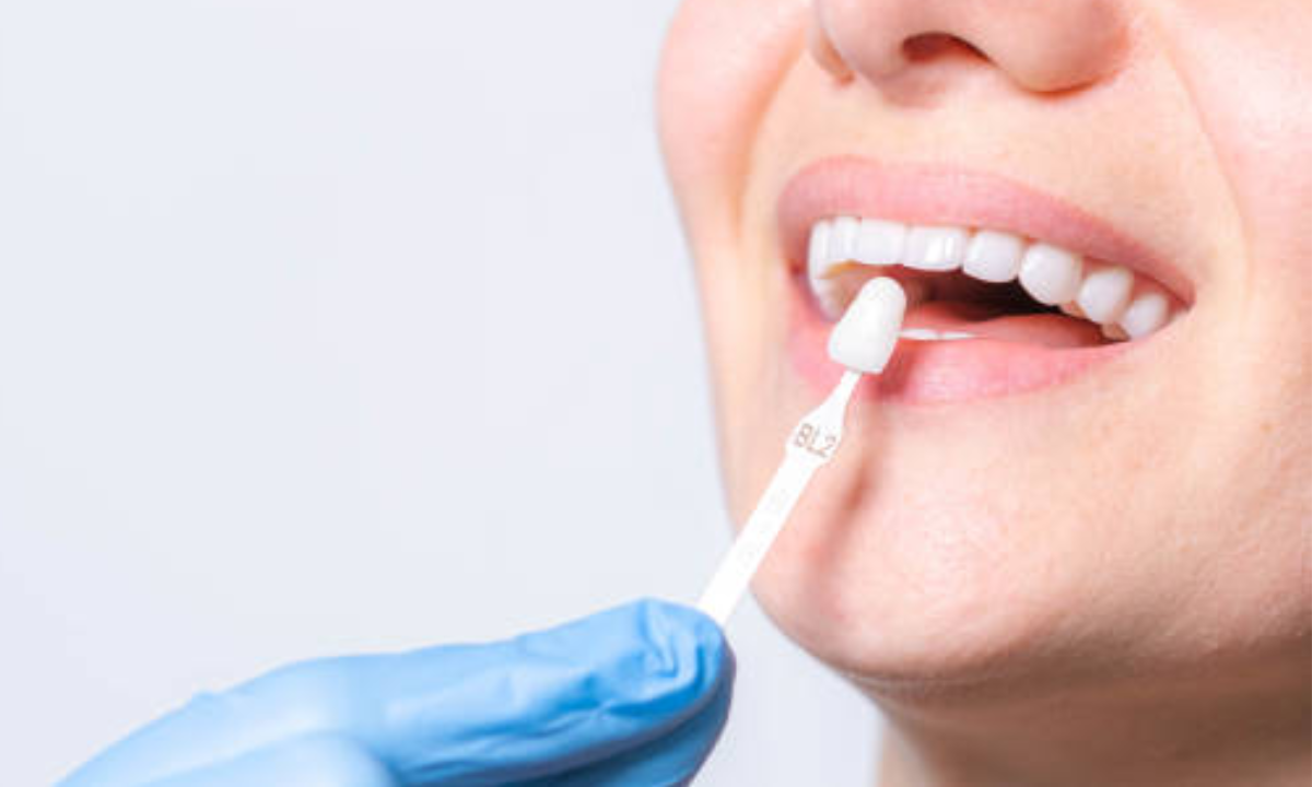 cosmetic dentist