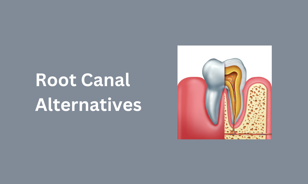 root canal treatment