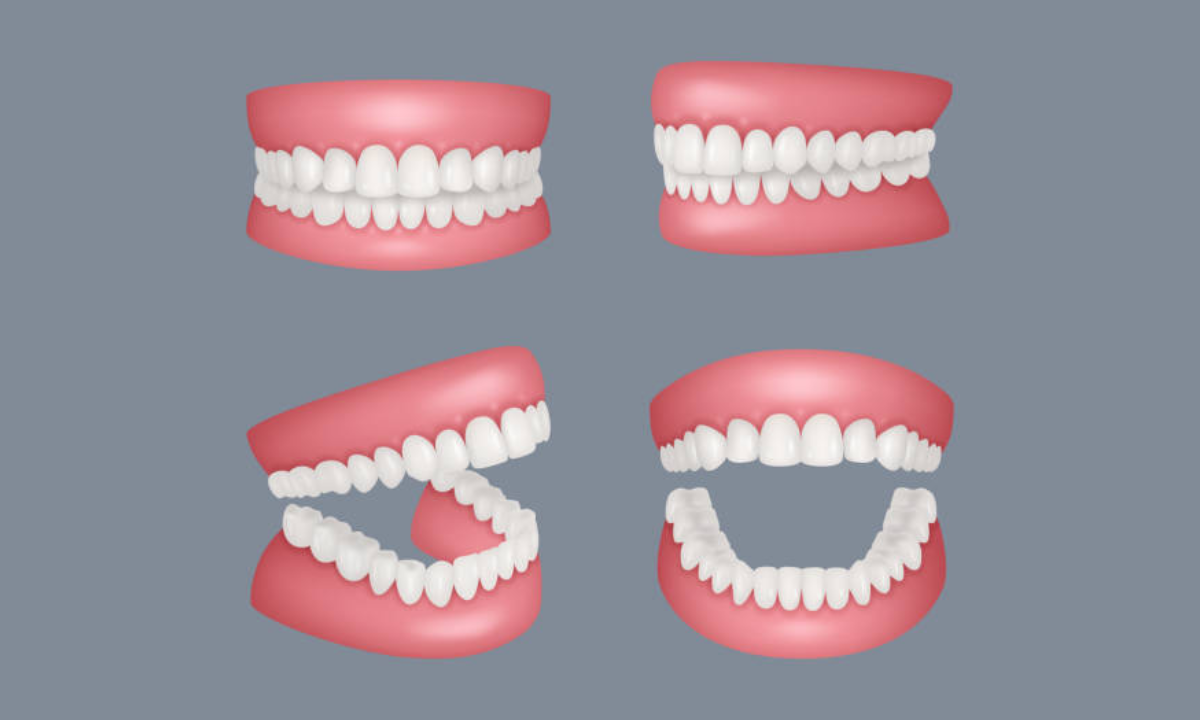 orthodontic treatment in whitefield