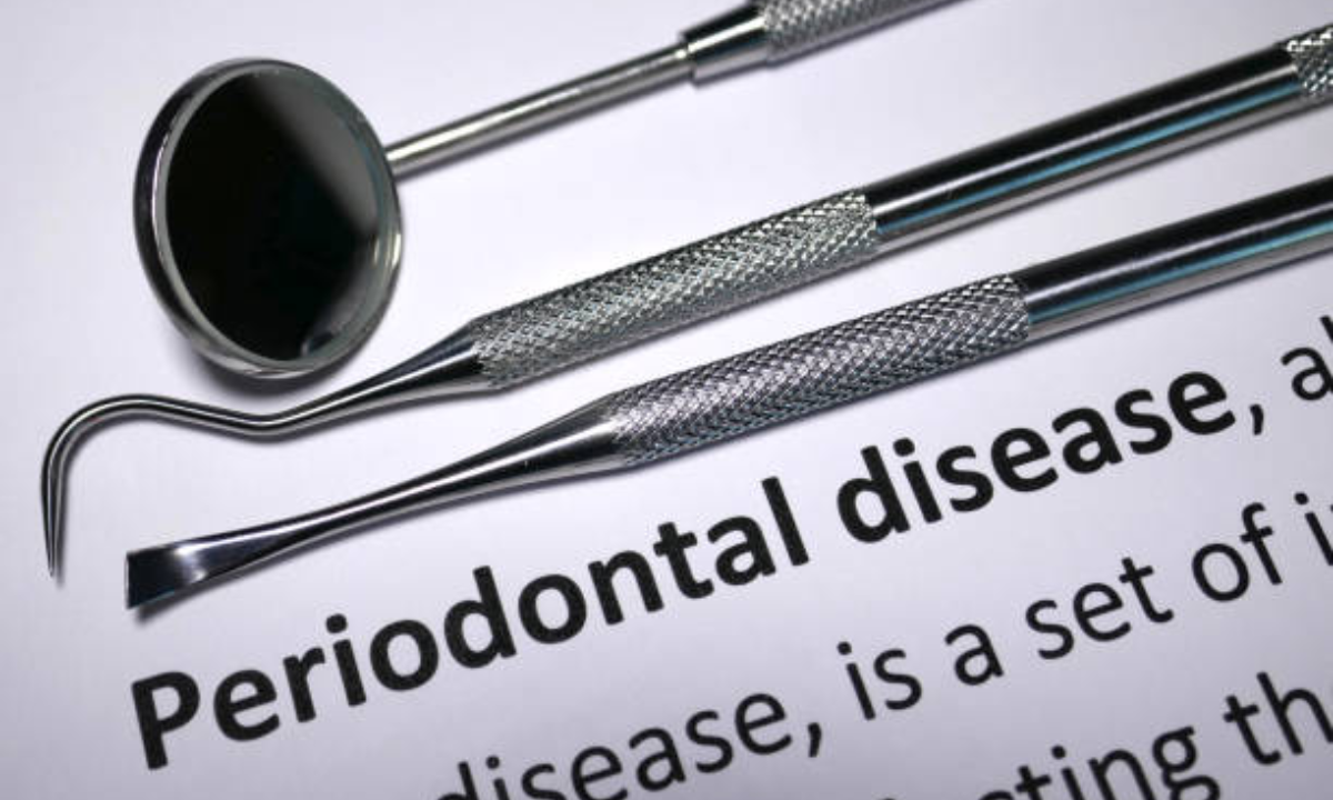 gum disease treatment in whitefield