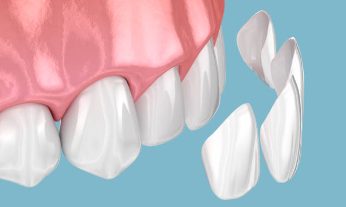 cosmetic dentistry in whitefield