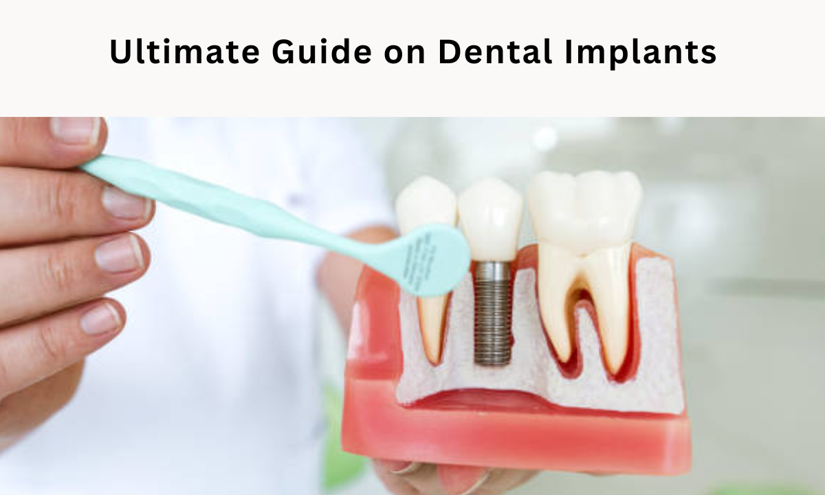 dental implants in whitefield