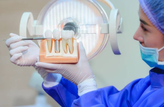 dental implant procedures