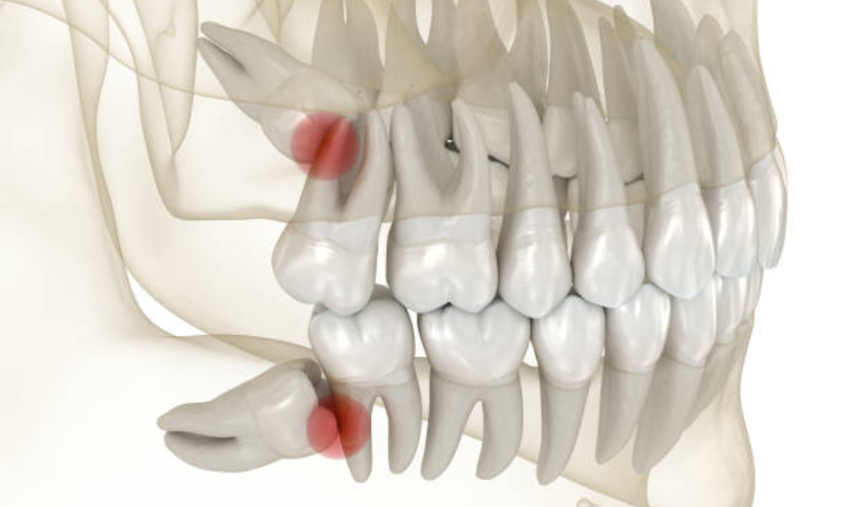 dental clinic in whitefield
