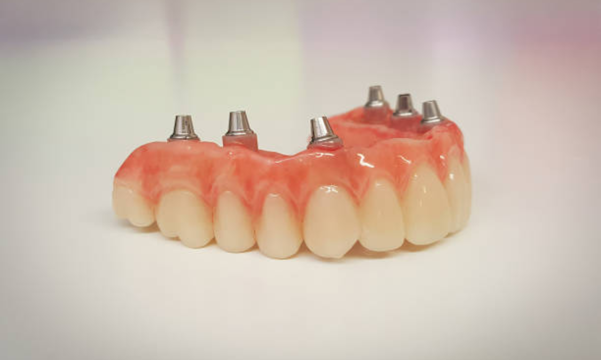 dental clinic in whitefield