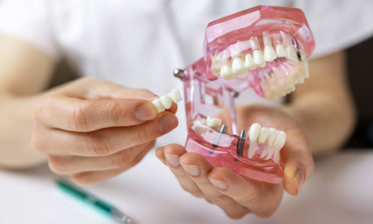 dental implants in whitefield