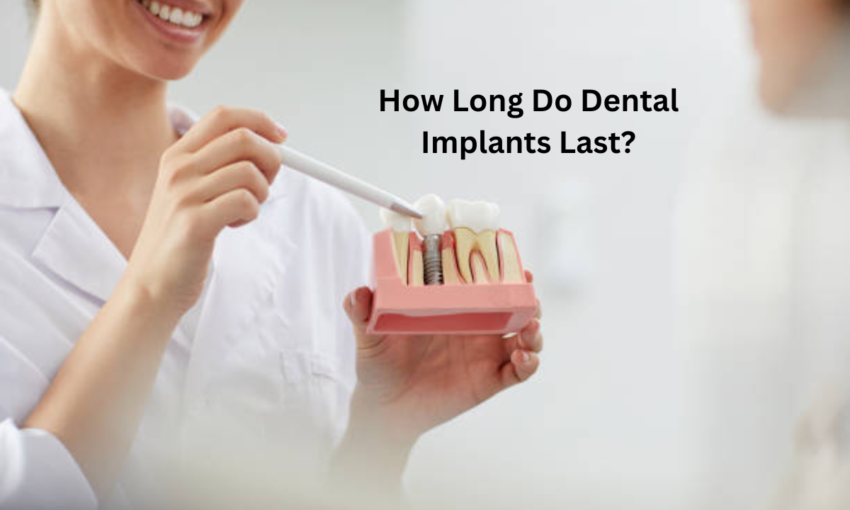dental implants