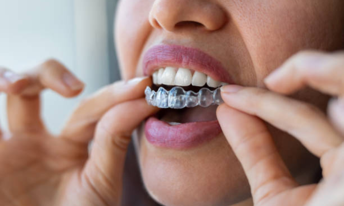 invisible braces in whitefield