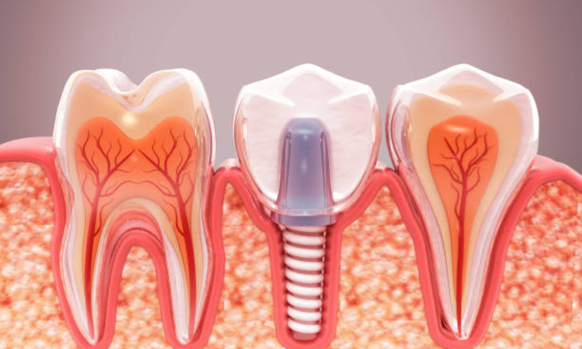 dental clinic in whitefield