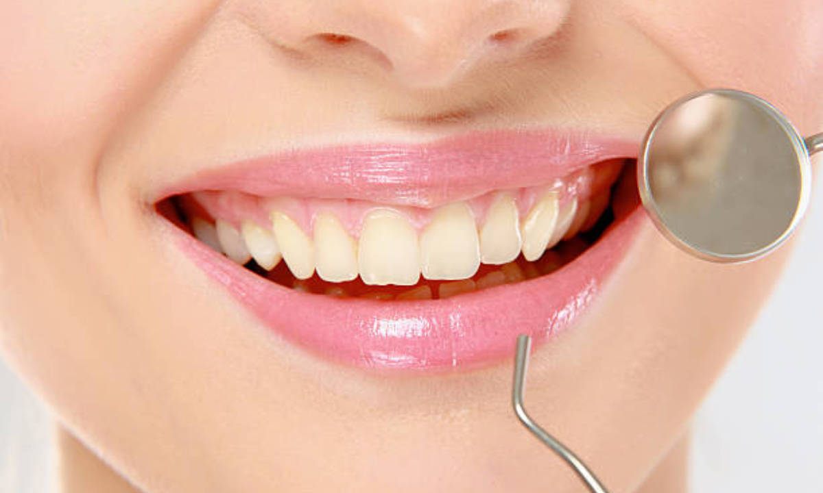 Guide to Cosmetic Dental Treatments: Options, Cost & Results