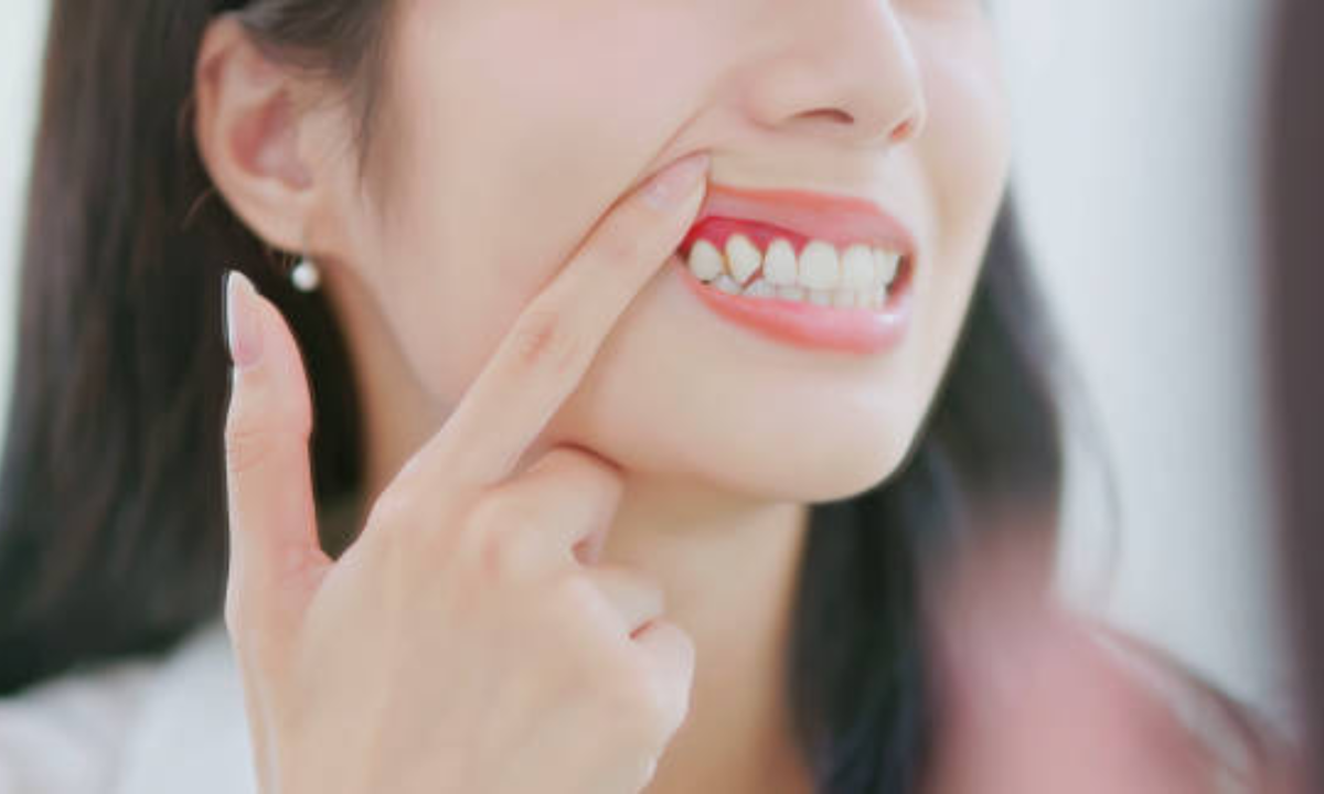 Gum disease treatment in Whitefield
