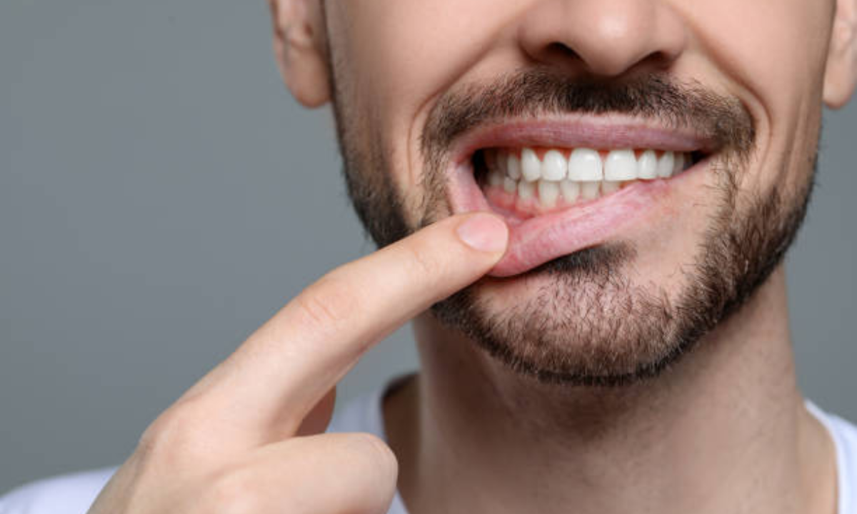 Gum disease treatment in Whitefield