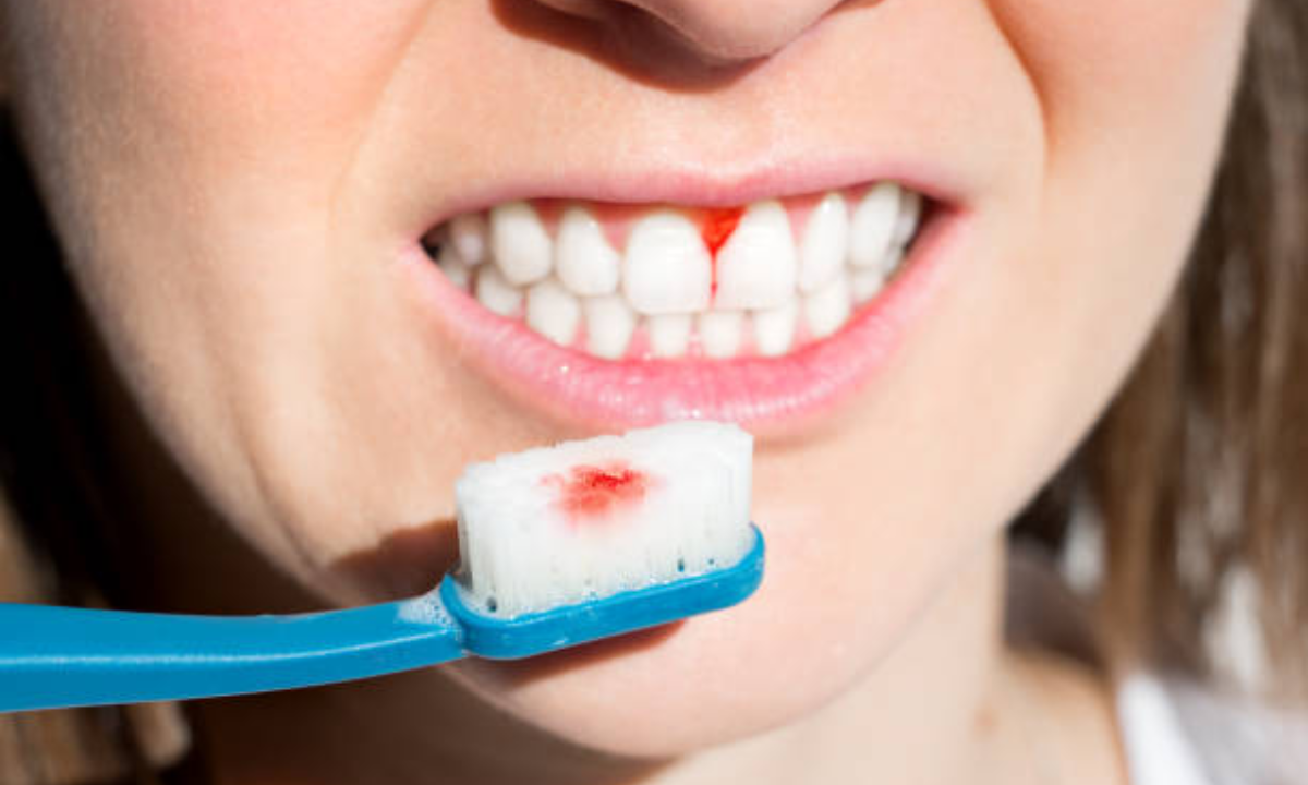 Gum disease treatment