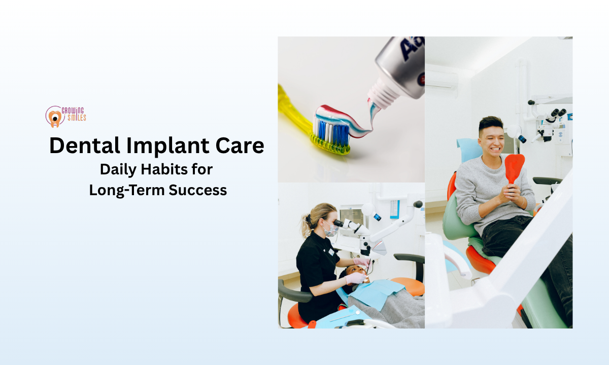 Caring for Dental Implants