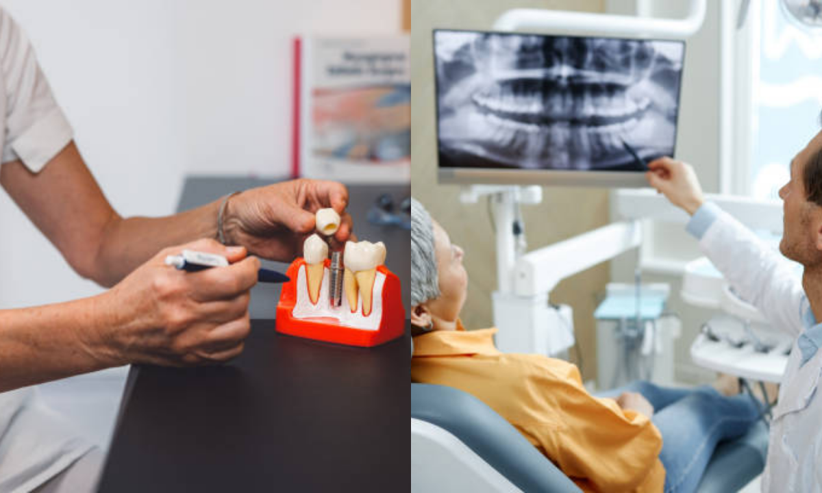 Dental Implant in Whitefield