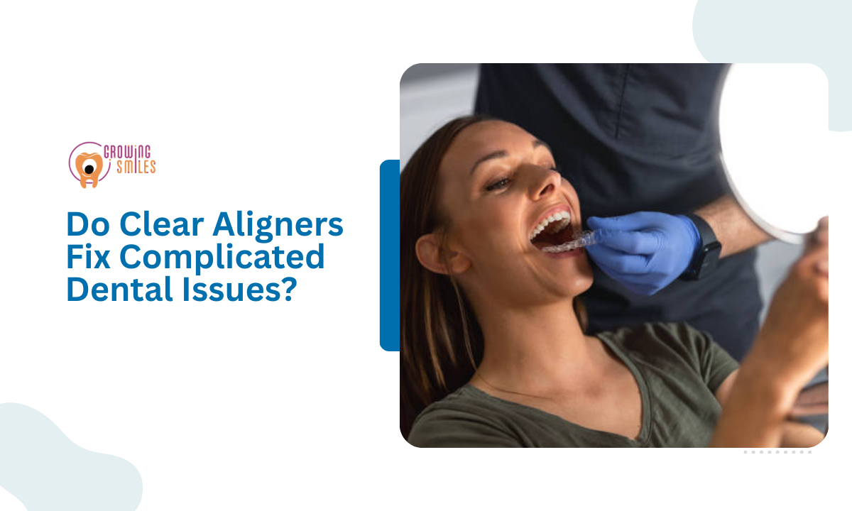 Clear aligners